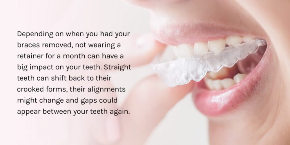 The Journey to Having Perfect, Straight Teeth!